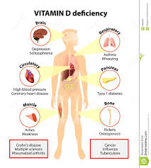 deficienciadevitaminad